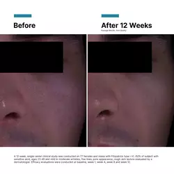 P-TIOX Anti-Wrinkle Cream