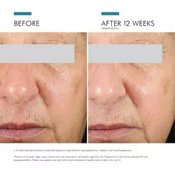 Daily-Brightening-UV-Defense-Sunscreen-SPF-30-3606000578579-SkinCeuticals