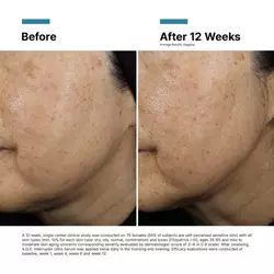 A.G.E. Interrupter Ultra Serum