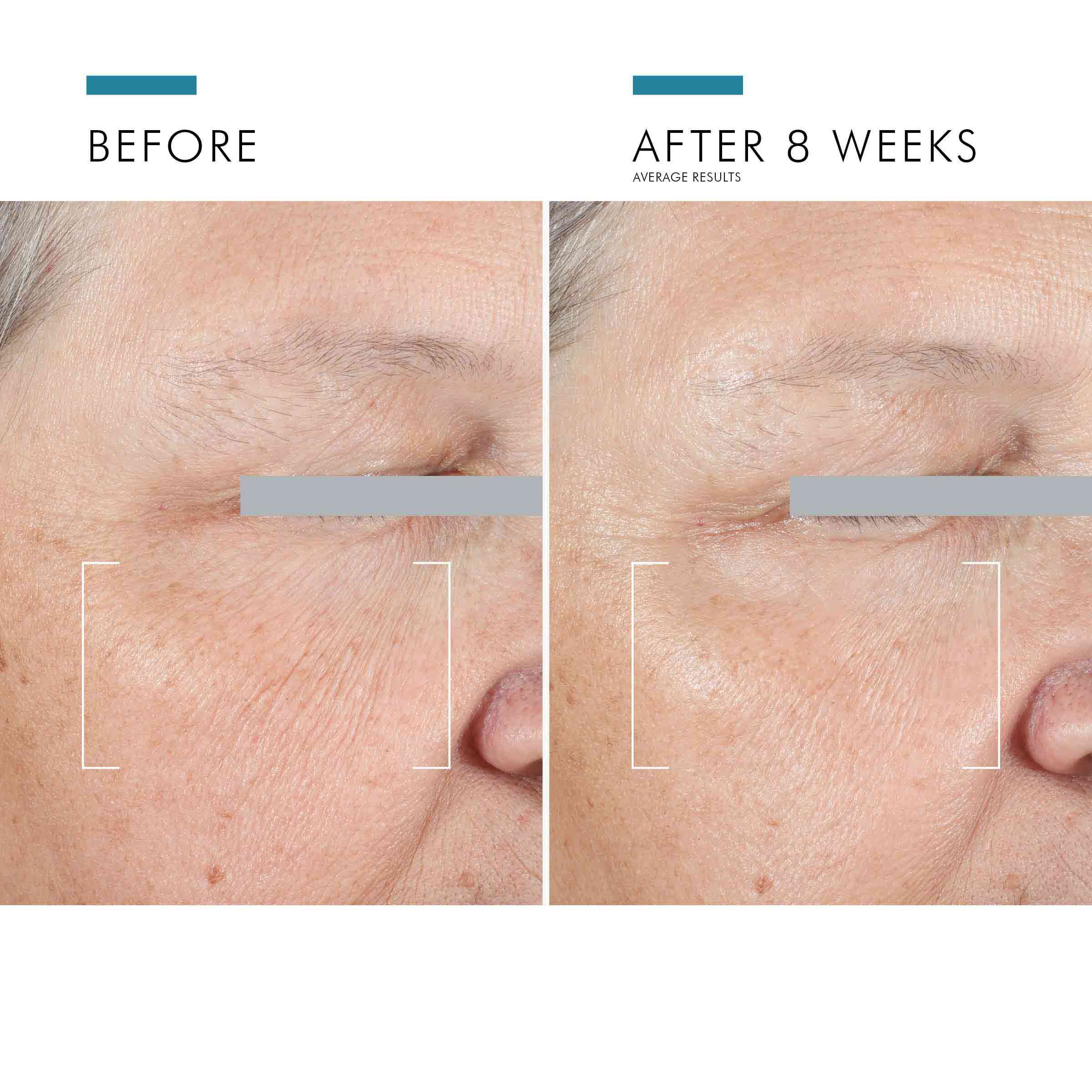 Skinceuticals eye shop balm