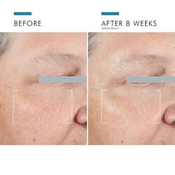 Eye Cream Secrets Your Dark Circles Will Regret