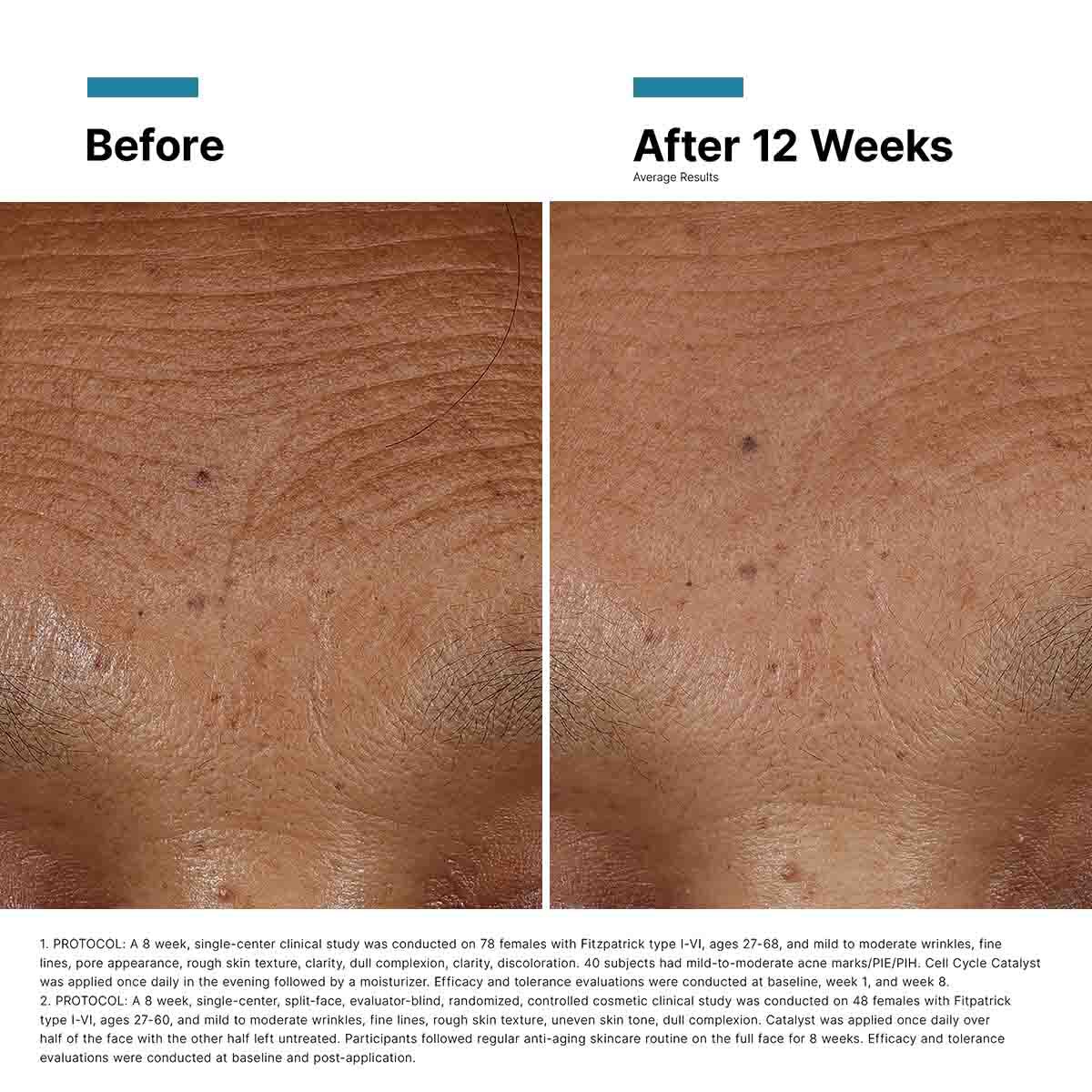 Hyaluronic Acid Intensifier Multi-Glycan