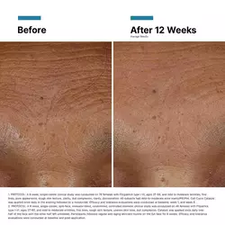 Hyaluronic Acid Intensifier Multi-Glycan