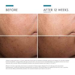 Discoloration Defense