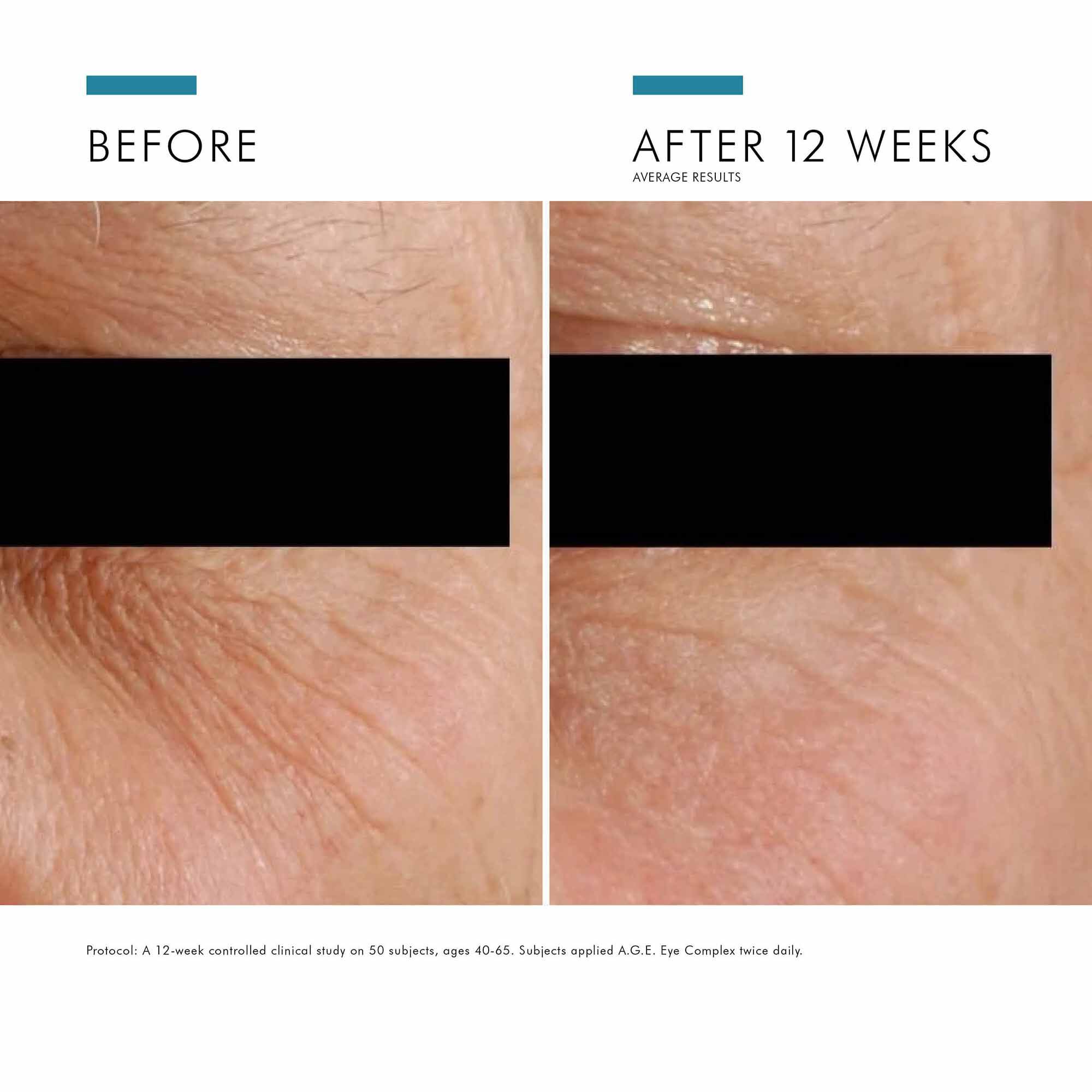A.G.E. Eye Complex for Dark Circles