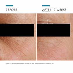 A.G.E. Eye Complex for Dark Circles