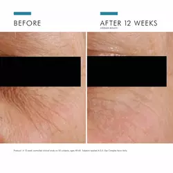 A.G.E. Eye Complex for Dark Circles