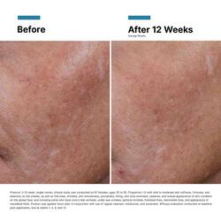 Hyaluronic Acid Intensifier Multi-Glycan