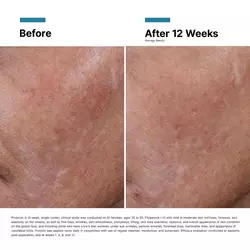 Hyaluronic Acid Intensifier Multi-Glycan