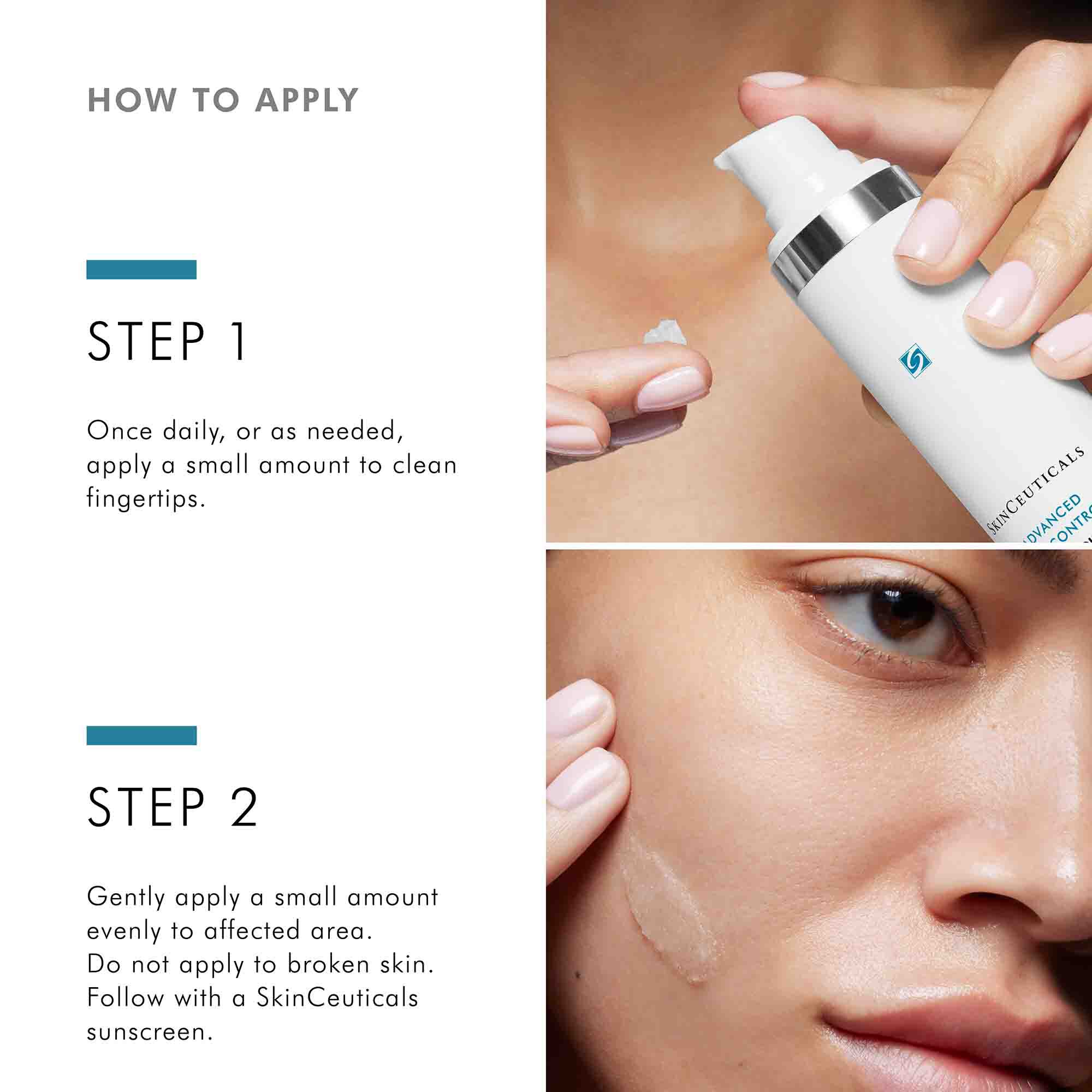 Advanced Scar Control