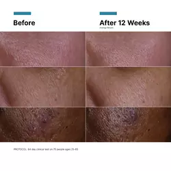 C E Ferulic® with 15% L-Ascorbic Acid