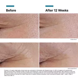 P-TIOX Anti-Wrinkle Serum