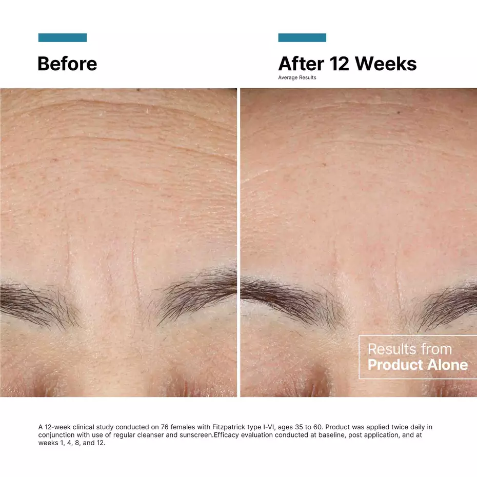 SkinCeuticals Regenerating Treatment 50ml – Renewing Face Cream That Revitalises Tired Skin, Smooths Texture & Restores a Healthier, Fresher, More Radiant-Looking Complexion