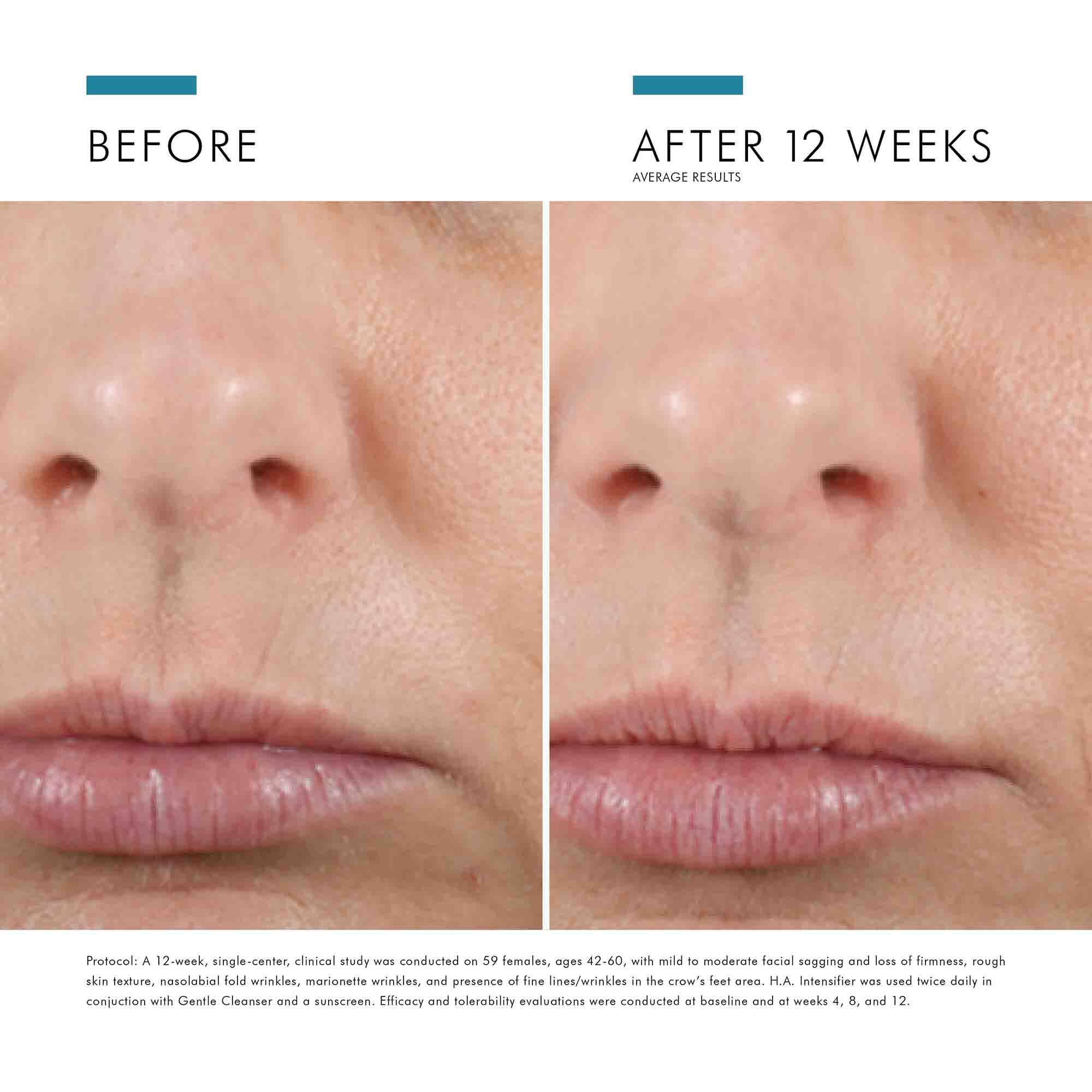 Skinceuticals hyaluronic acid on sale intensifier