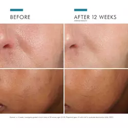 Phloretin-CF-with-Ferulic-Acid-635494328004-SkinCeuticals