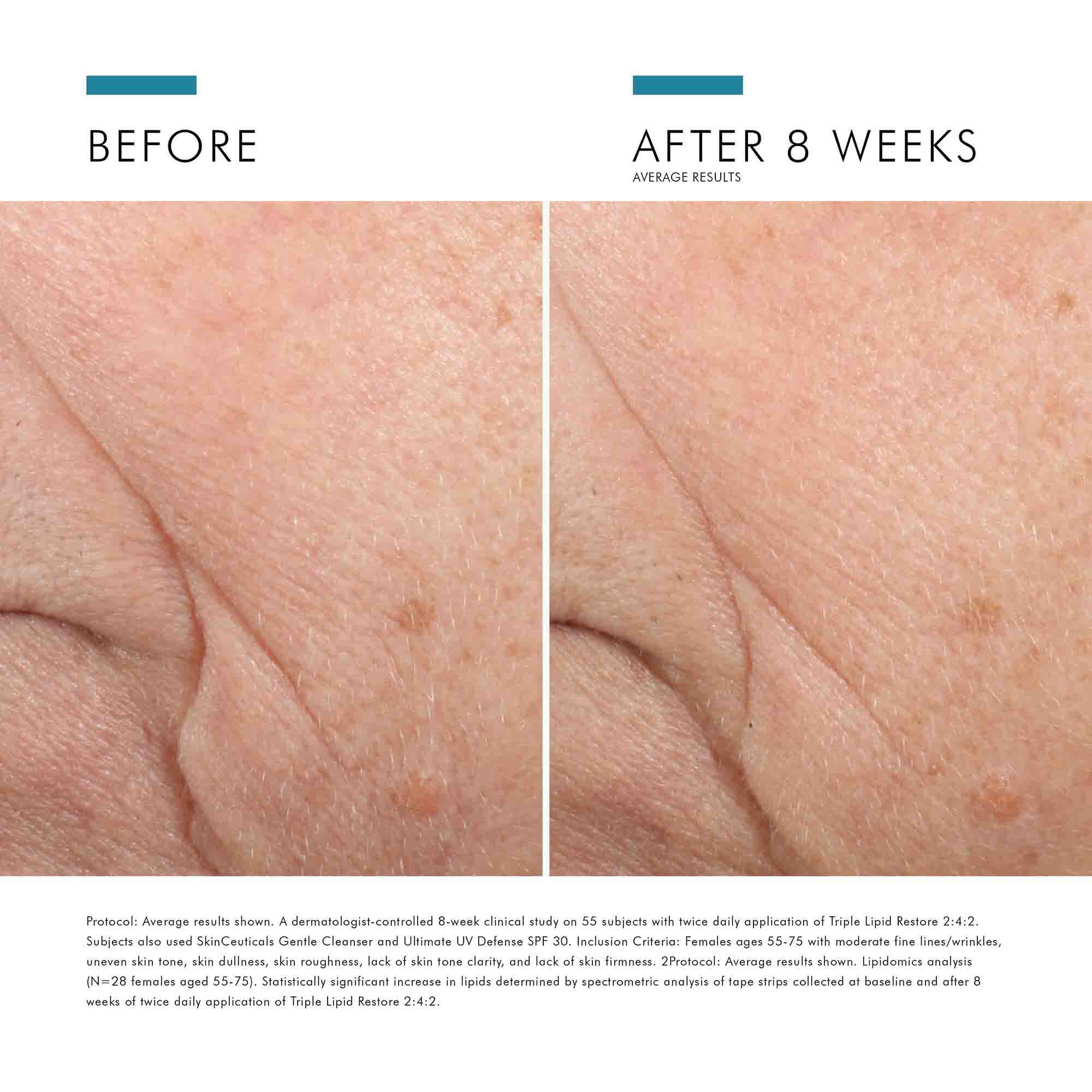 Triple Lipid Restore 2 4 2 Anti Aging Moisturizer Cream