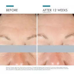 A.G.E. Interrupter Advanced Cream