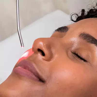 IPL Laser