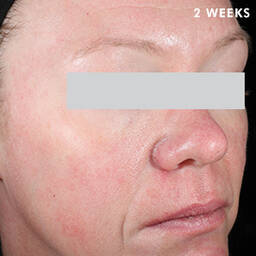 Skinceuticals After