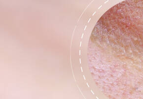 Anti-Aging Creams SkinCeuticals