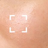 Combination Skin