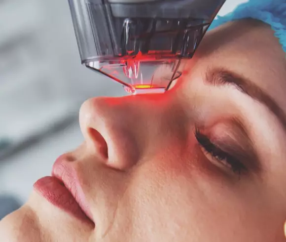 Fraxel Laser at a Glance Image