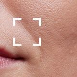 Anti-Aging