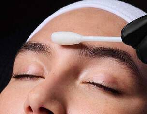 Deep Chemical Peel Banner