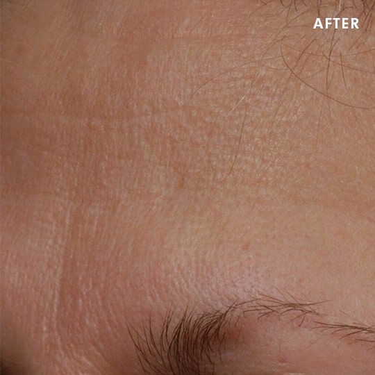 Skinceuticals After
