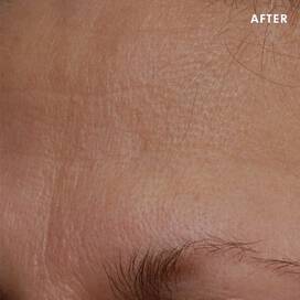 Skinceuticals After