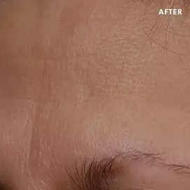 Skinceuticals After