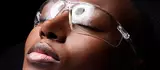 Compare Treatment Benefits Pico Laser Image