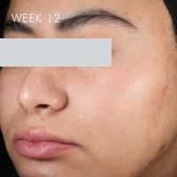 Skinceuticals After