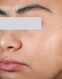 Skinceuticals After