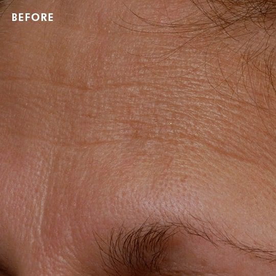 Skinceuticals Before