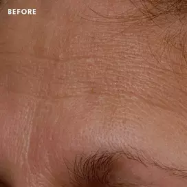 Skinceuticals Before