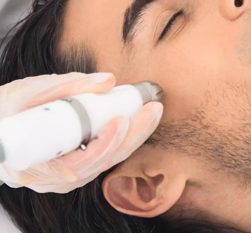 Skin Treatment for Acne