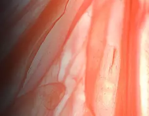 Myrixin Ingredient Image