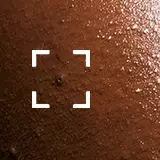 Adult Acne