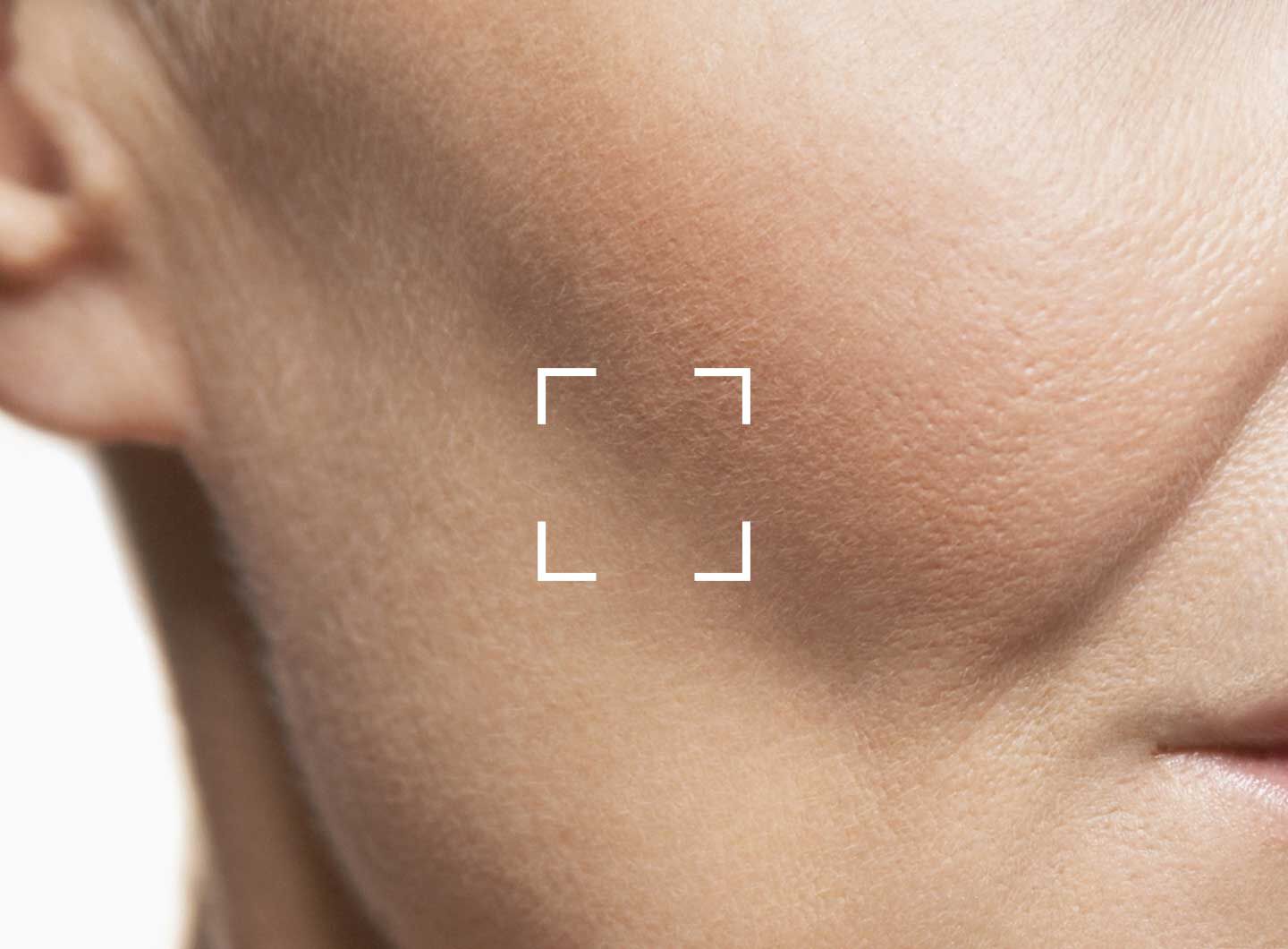 How to Minimize Bruising After Lip Filler Banner