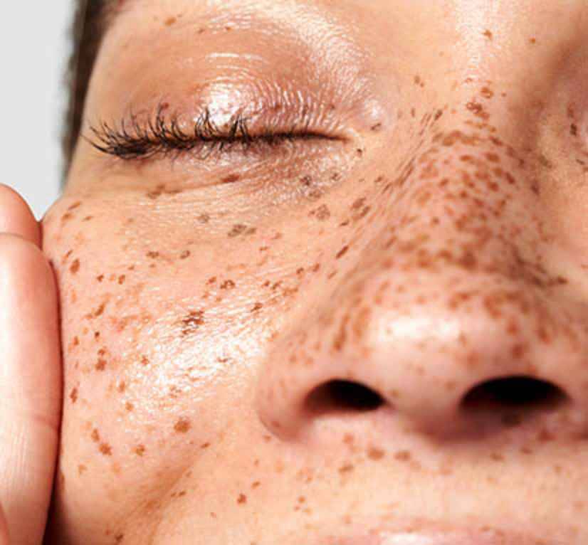 Corrective moisturizers
